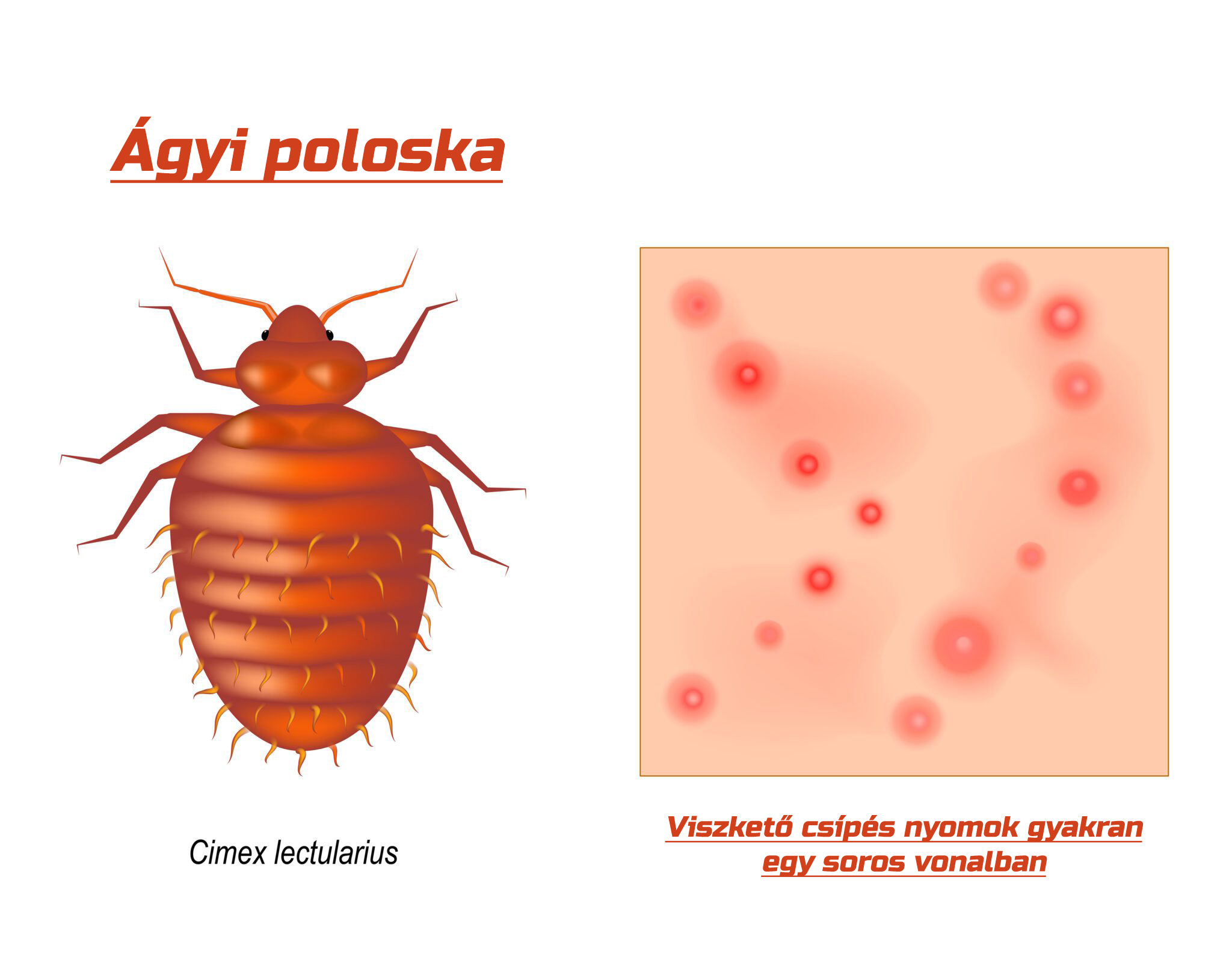 ágyi poloska csípések